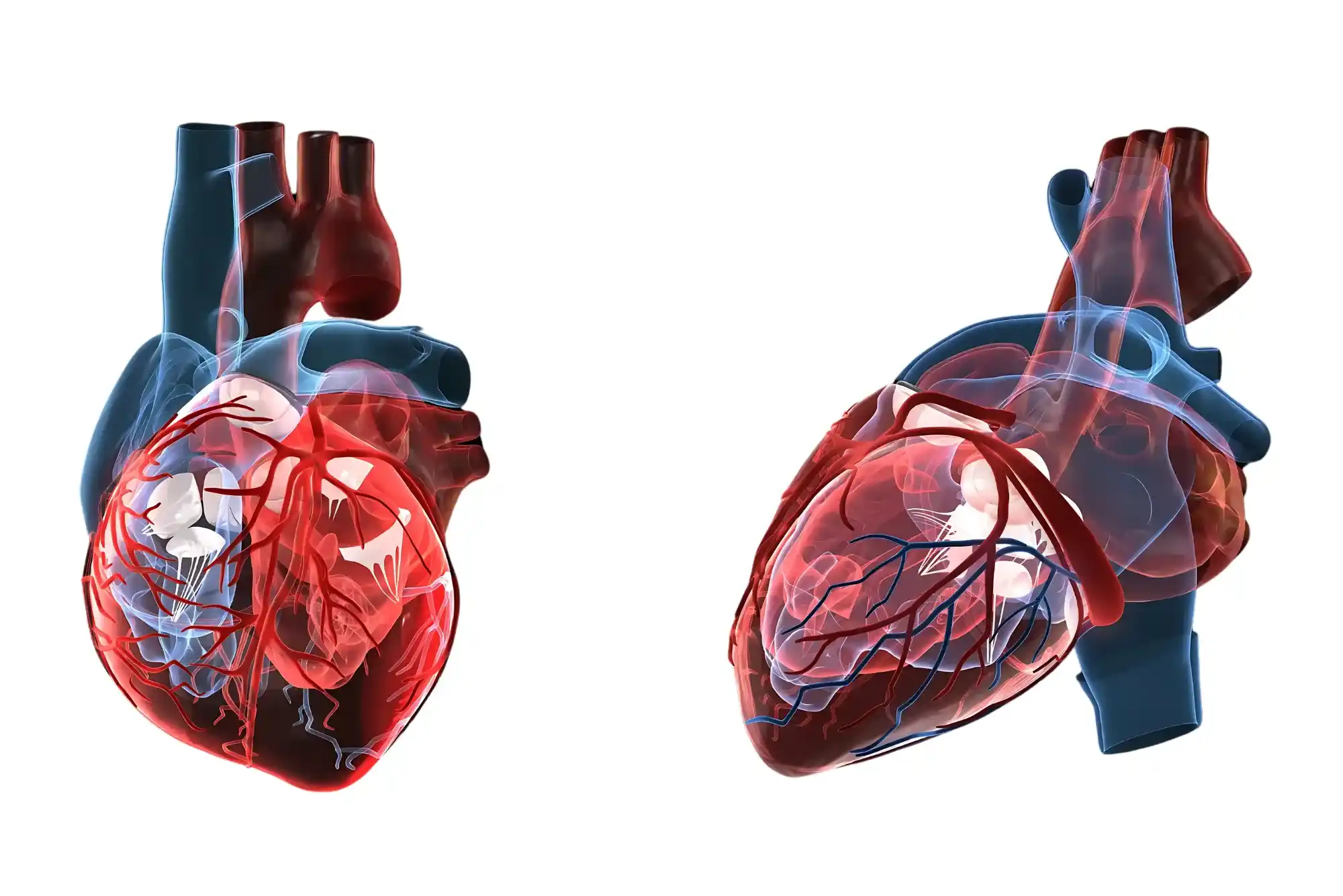 الرجفان الأذيني والقسطرة الكهربائية (Ablation)